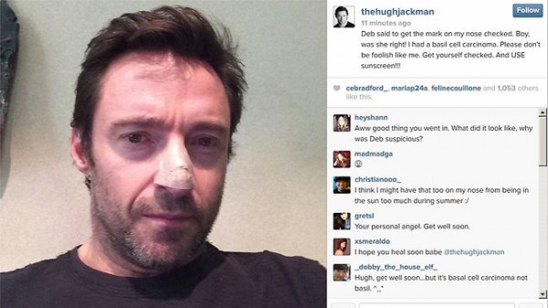 hugh-jackman-tiene-cáncer-de-piel