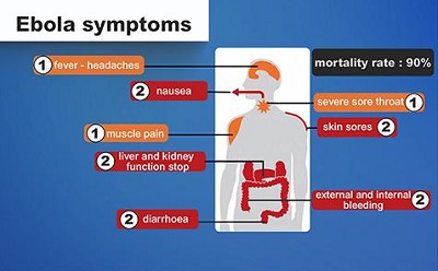 ebola-virus