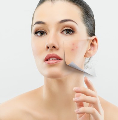 Cómo mejorar el acné adulto