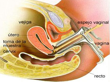 Citología vaginal